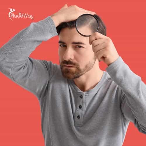 Why British Men are Choosing Turkey Over London for Advanced DHI Hair Transplants